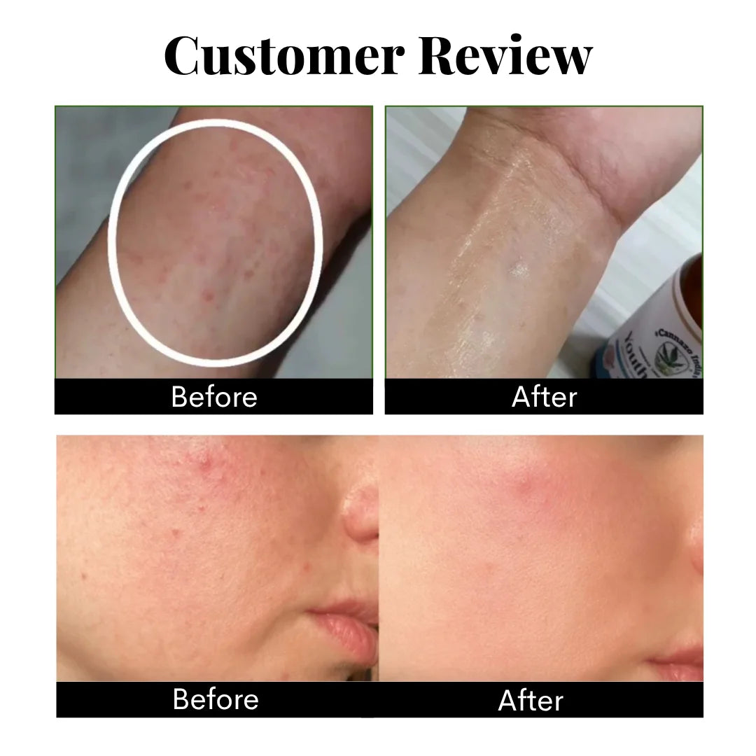 CANNAZO-Daily Skin Repair Cream